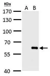Anti-Influenza B virus Nucleoprotein antibody used in Western Blot (WB). GTX128538